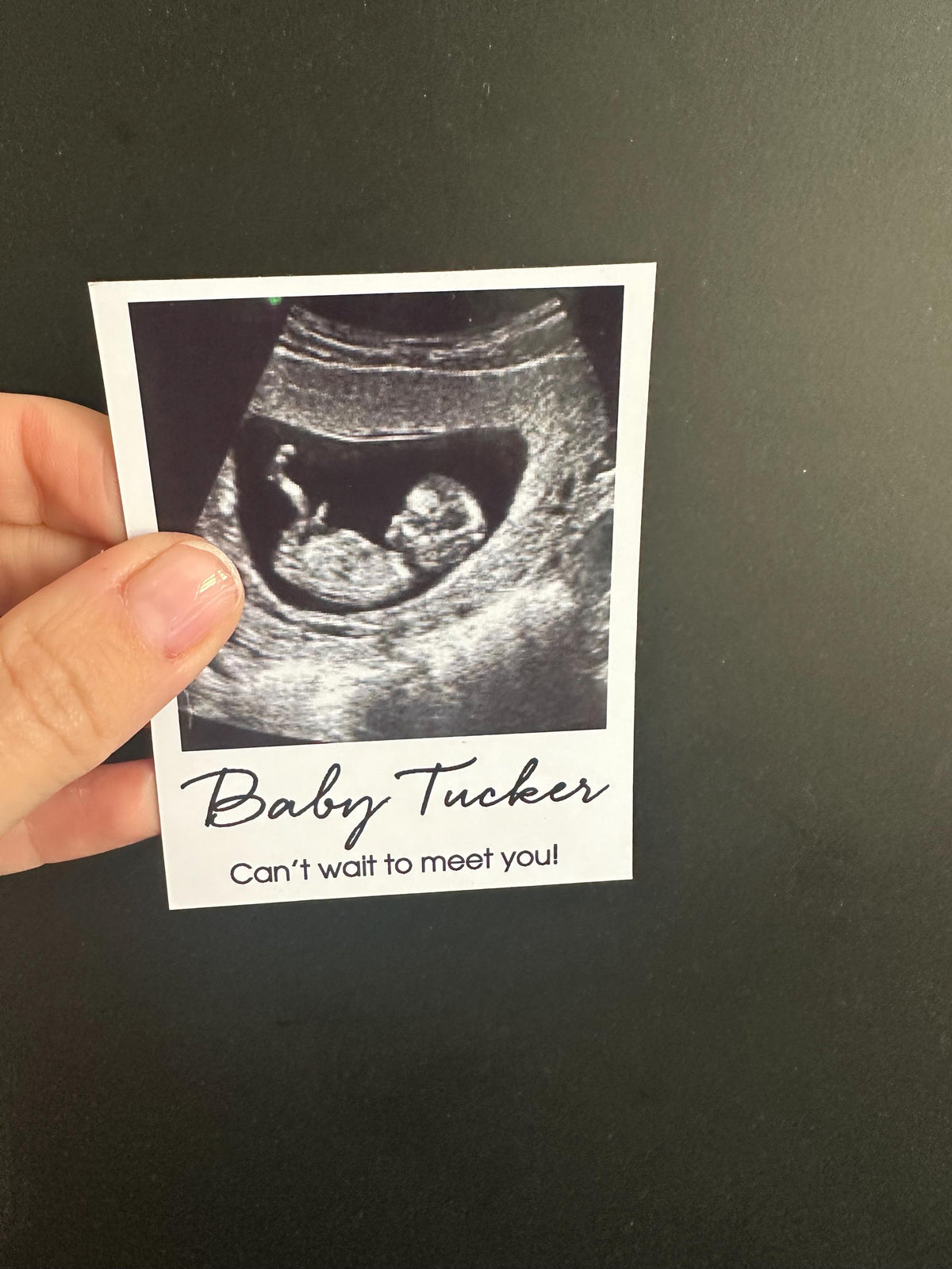 Happy Mother’s Day – Ultrasound Scan Magnet Card | Pregnancy Announcement | Love From The Bump